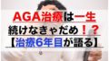 AGA治療は一生続けなきゃだめ！？【治療6年目が語る】